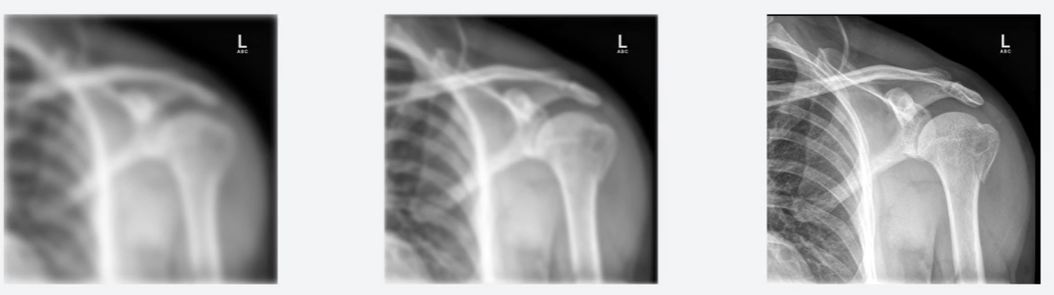 Image Quality Factors: What Makes a Radiograph Diagnostic ...