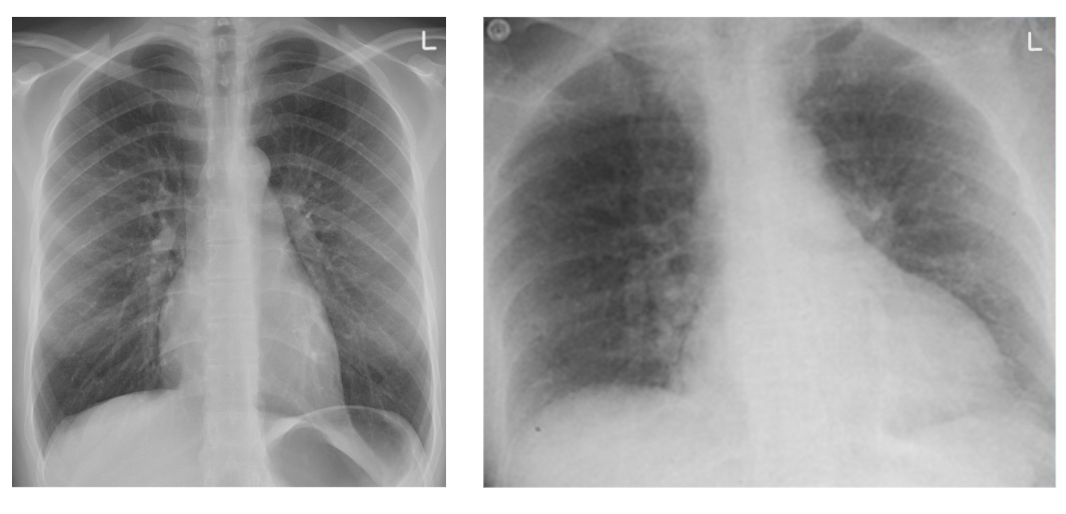 Image Quality Factors: What Makes a Radiograph Diagnostic ...
